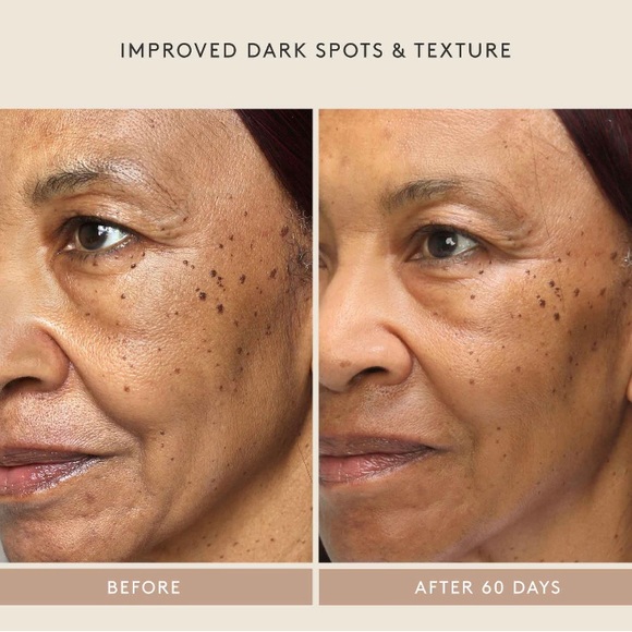 ๐2/$28 or 3/$38๐ Shani Darden Retinol Reform - Picture 6 of 8